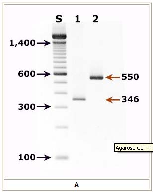 Agarose gel - PCR for Pneumocystis