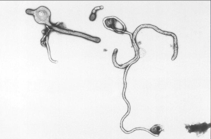 Negatively-stained transmission electron micrograph (TEM) demonstrating the ultrastructural curvilinear morphologic features displayed by the Ebola virus from the Ivory Coast of Africa.Adapted from Public Health Image Library (PHIL), Centers for Disease Control and Prevention.[20]