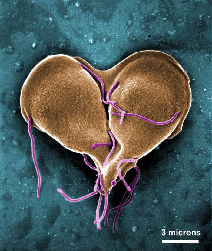 SEM depicts a Giardia lamblia protozoan that was about to become two separate organisms, as it was caught in a late stage of cell division. From Public Health Image Library (PHIL). [1]