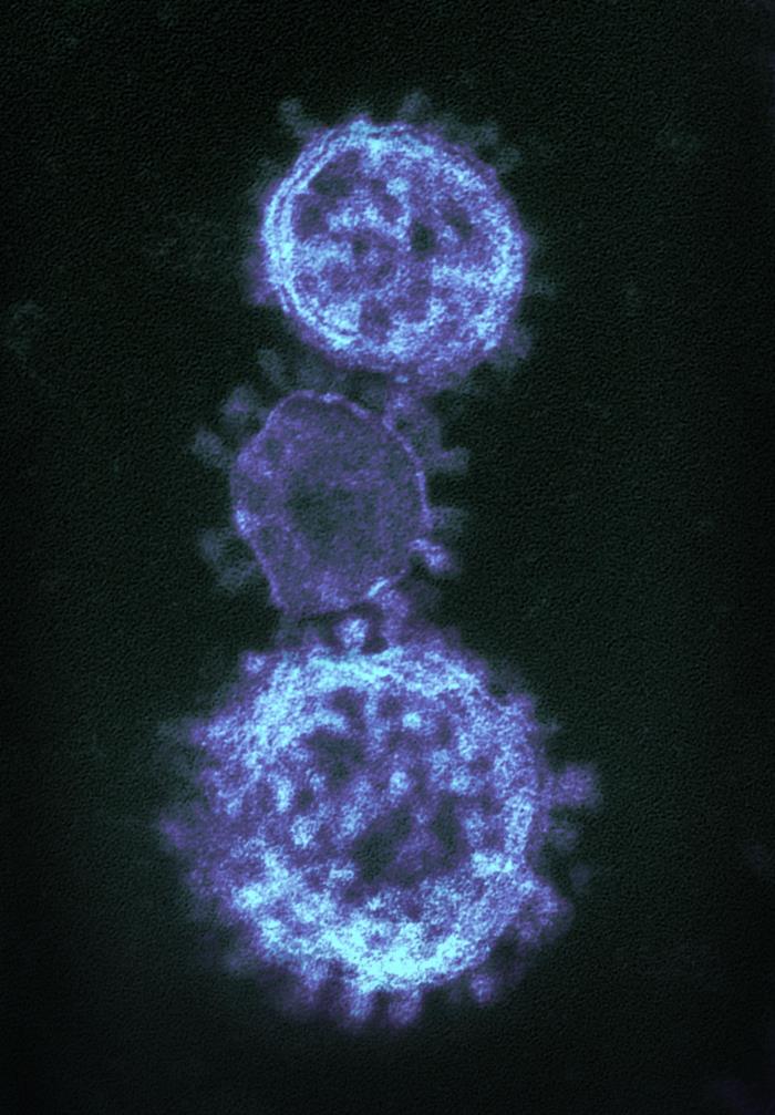 TEM reveals ultrastructural details exhibited by three spherical-shaped Middle East Respiratory Syndrome Coronavirus (MERS-CoV) virions. From Public Health Image Library (PHIL). [16]