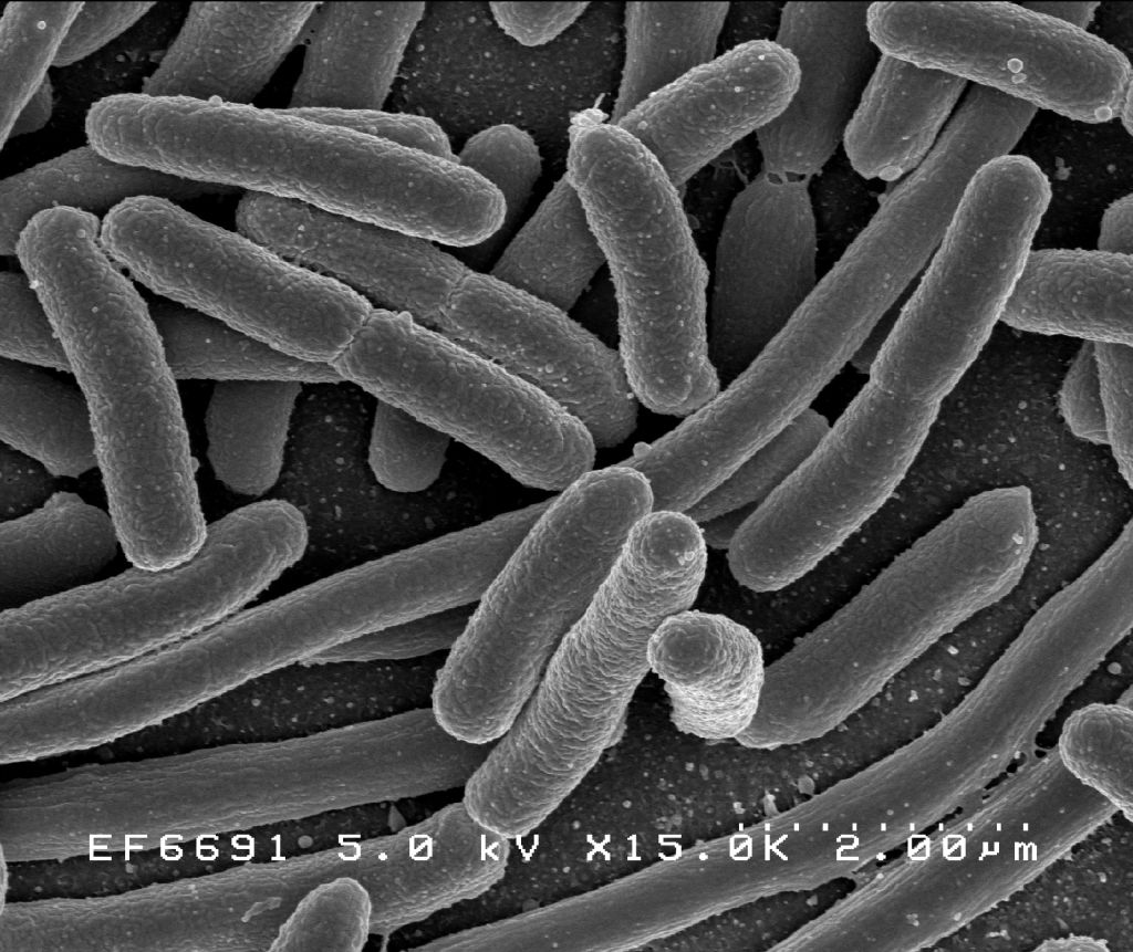 These Escherichia coli cells provide an example of a prokaryotic microorganism