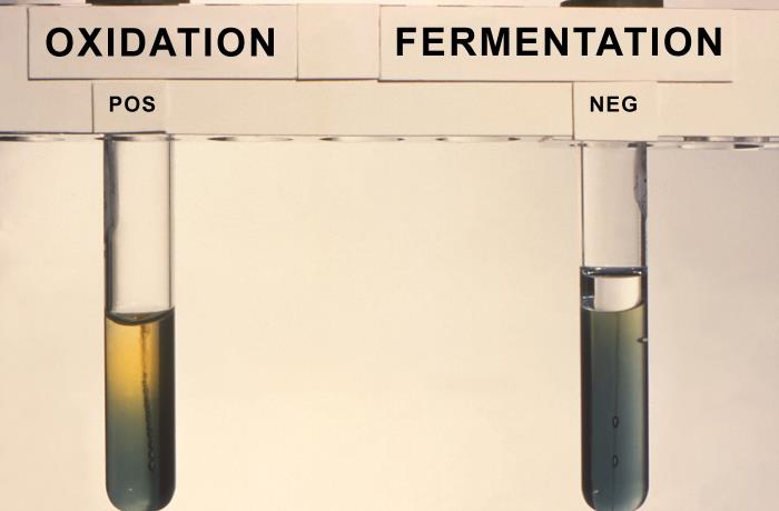 Enterobacteriaceae cultures show positive oxidation (Rt), and negative fermentation reactivity in glucose medium (Lt). From Public Health Image Library (PHIL). [1]