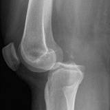 File:Knee dislocation 2.jpg