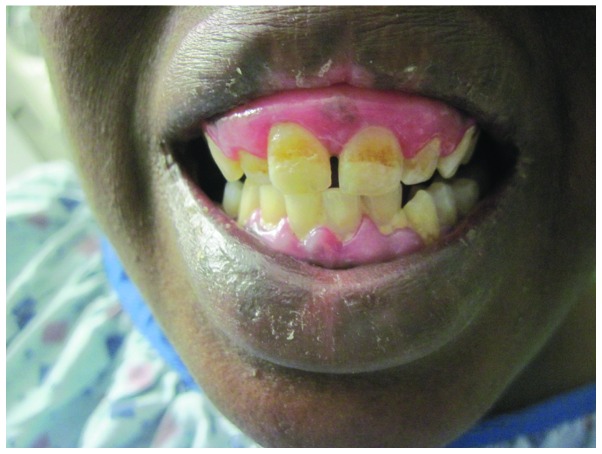 File:Dental abnormalities.jpg