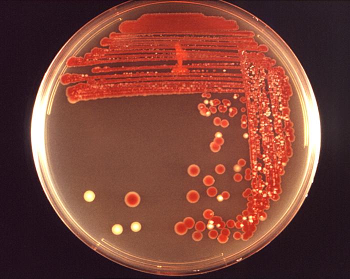 Blood agar base plate cultivated colonial growth of Gram-negative, rod-shaped and facultatively anaerobic Serratia marcescens bacteria. From Public Health Image Library (PHIL). [2]