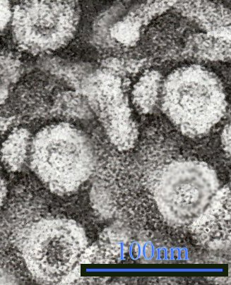 Micrograph showing hepatitis B virions - Author: GrahamColm na projektu Wikipedie v jazyce angličtina, CC BY 3.0, https://commons.wikimedia.org/w/index.php?curid=6032684