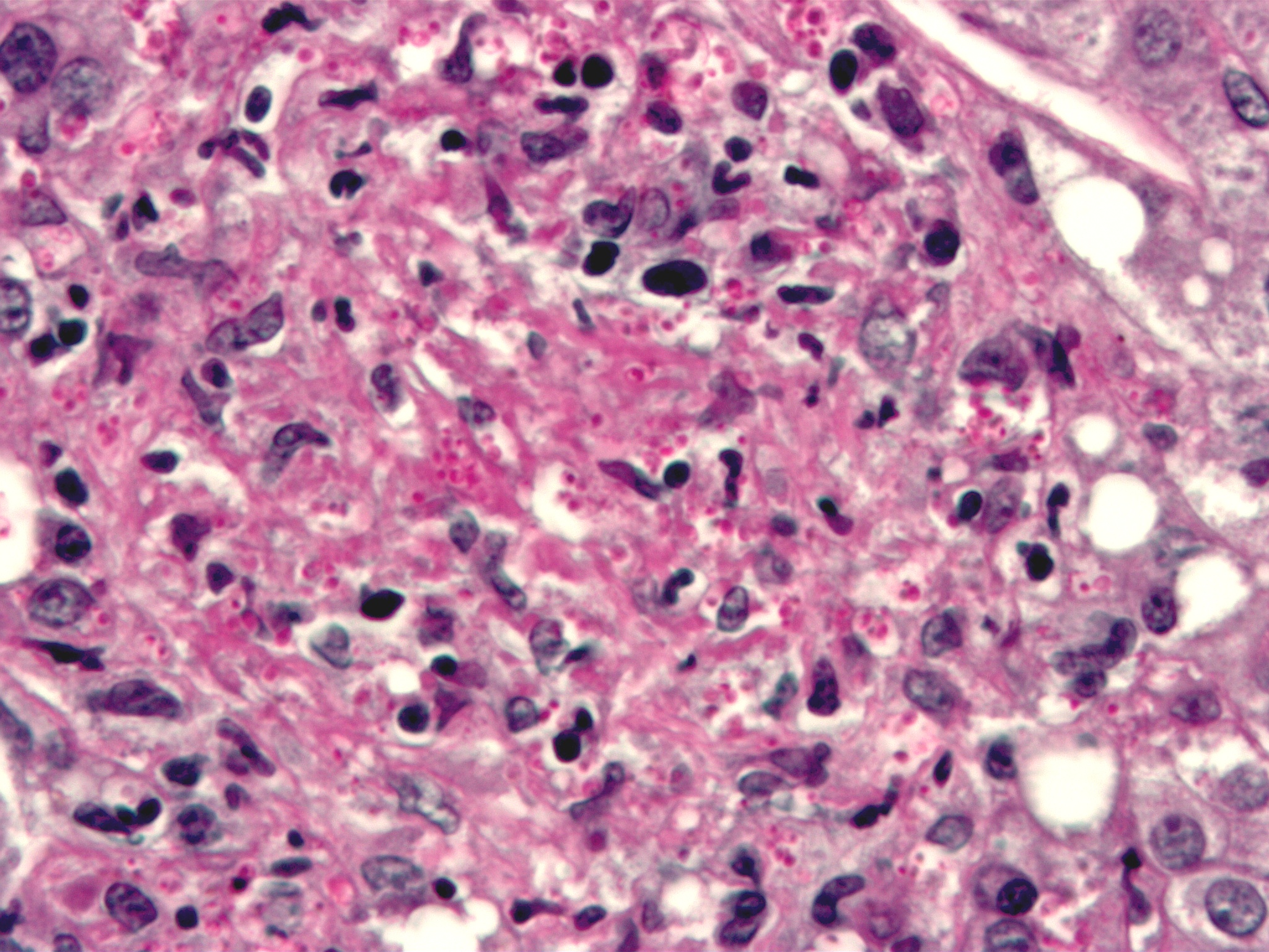File:Histoplasma pas-d.jpg