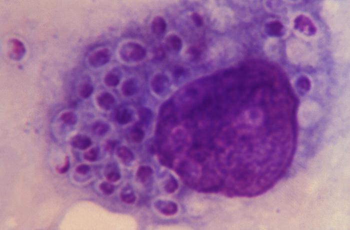 This Giemsa-stained photomicrograph reveals a histiocyte within which numerous Histoplasma capsulatum fungal organisms in their yeast-stage of development were contained. From Public Health Image Library (PHIL). [5]