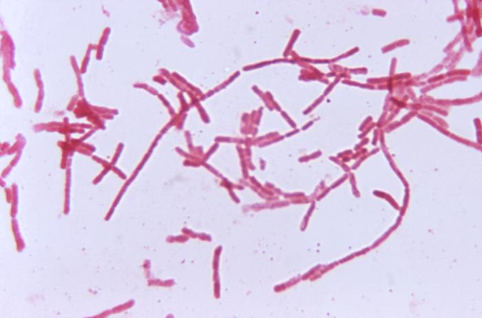 This photomicrograph shows the bacterium Bacteroides biacutus cultured in a thioglycollate medium for 48 hours. From Public Health Image Library (PHIL). [8]