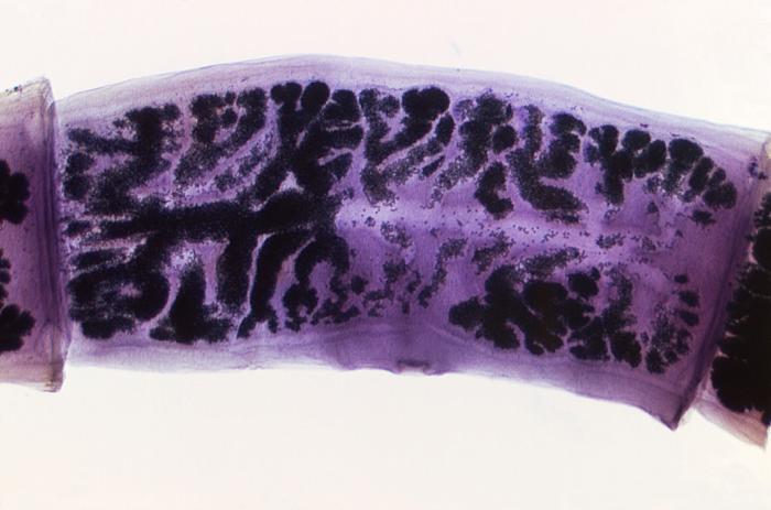 Photomicrograph depicts some of the ultrastructural morphology exhibited by three Taenia solium proglottids (8X mag). From Public Health Image Library (PHIL). [2]
