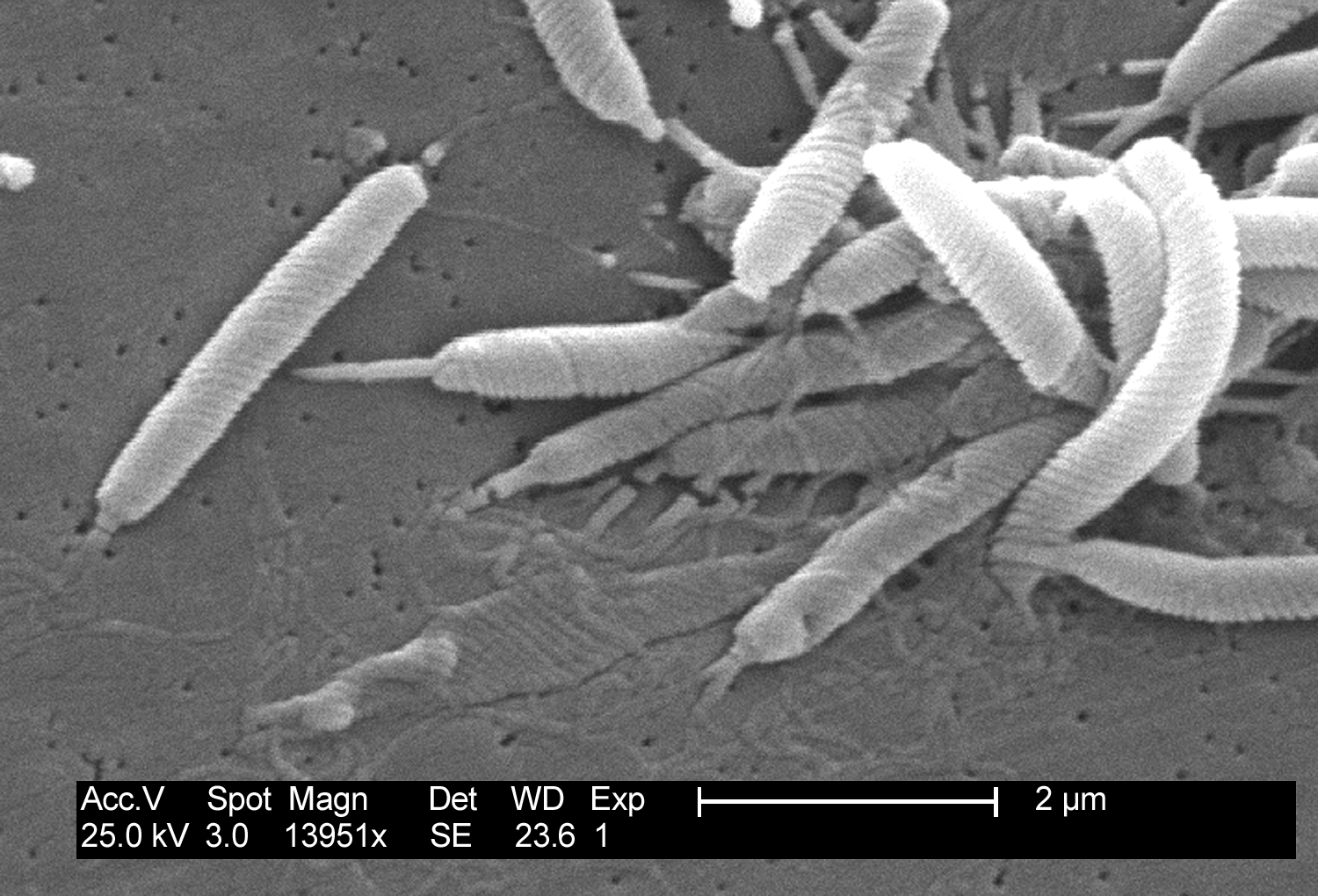 Scanning electron micrograph of Helicobacter bacteria.