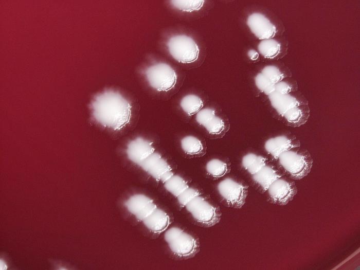 Yersinia pestis bacteria cultured on a sheep blood agar (SBA) medium 120hrs (10x mag). Adapted from Public Health Image Library (PHIL), Centers for Disease Control and Prevention.[6]