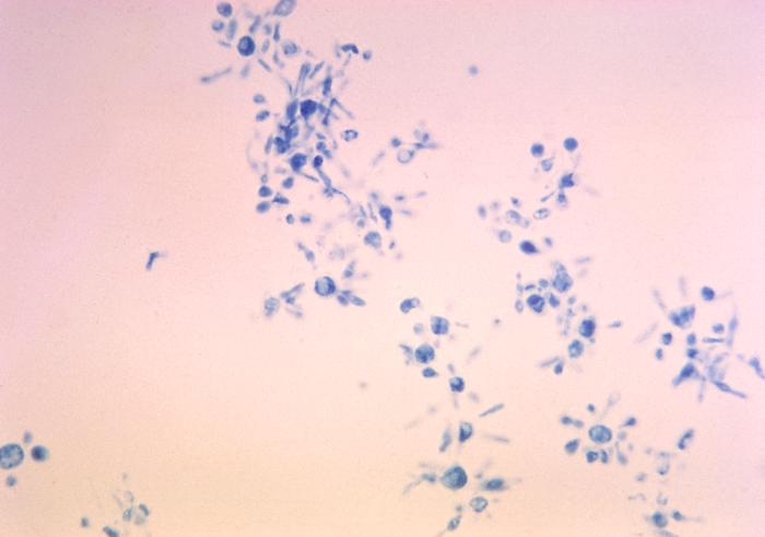 Photomicrograph depicts budding cells of the fungus Paracoccidioides brasiliensis during its yeast phase.. From Public Health Image Library (PHIL). [30]