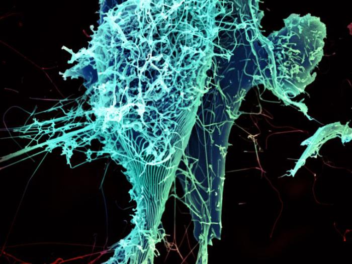 Produced by the National Institute of Allergy and Infectious Diseases (NIAID), this digitally-colorized scanning electron micrograph (SEM) depicts numerous string-like Ebola virus particles as they were in the process of being shed from an infected cell. From Public Health Image Library (PHIL). [8]