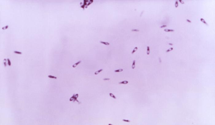 Gram-positive Clostridium subterminale bacteria on BAP medium 48hrs (956x mag). From Public Health Image Library (PHIL). [7]