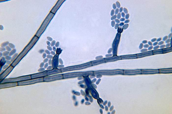 Photomicrograph depicts conidia-laden conidiophores of a Phialophora verrucosa fungal organism from a slide culture. From Public Health Image Library (PHIL). [3]