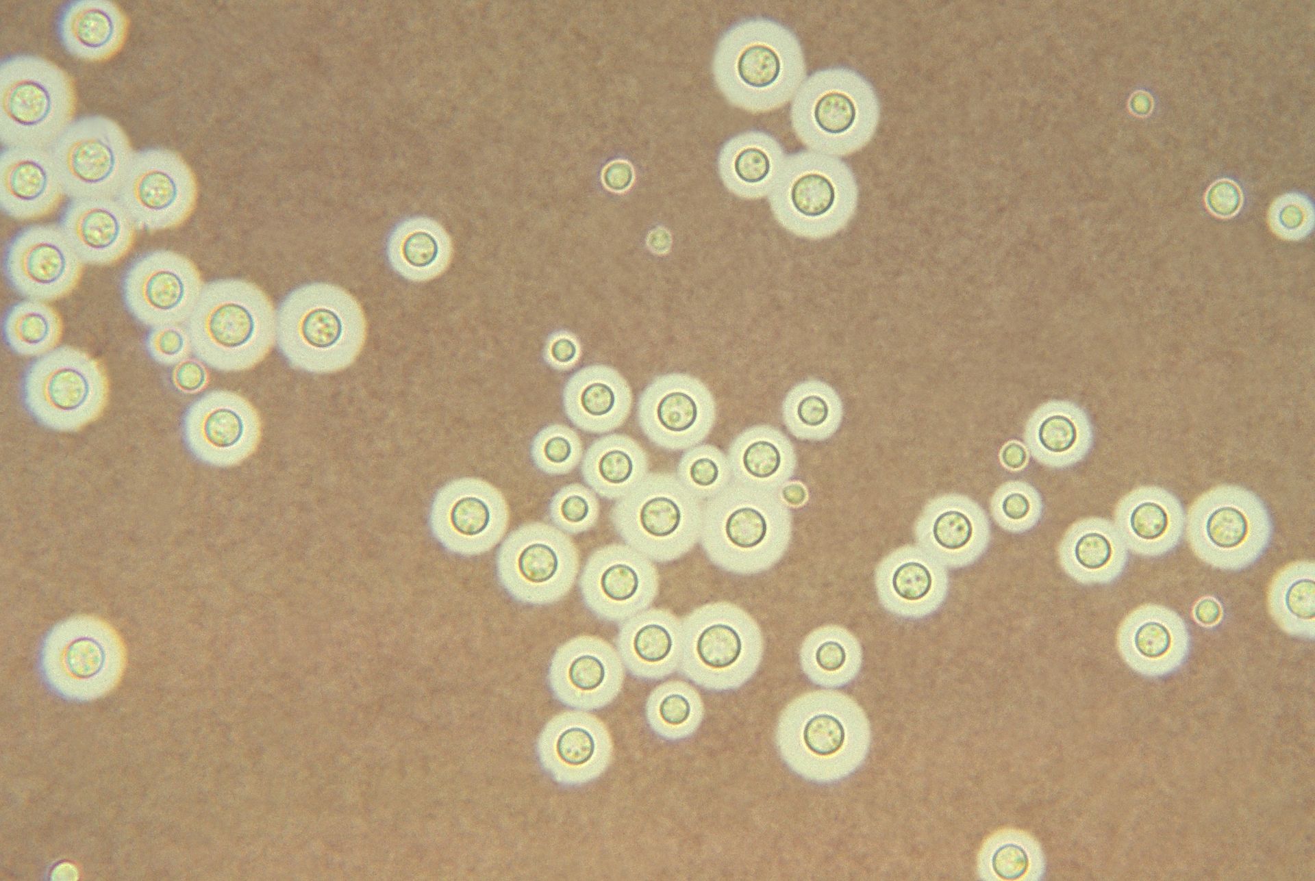File:Cryptococcus neoformans2.jpg