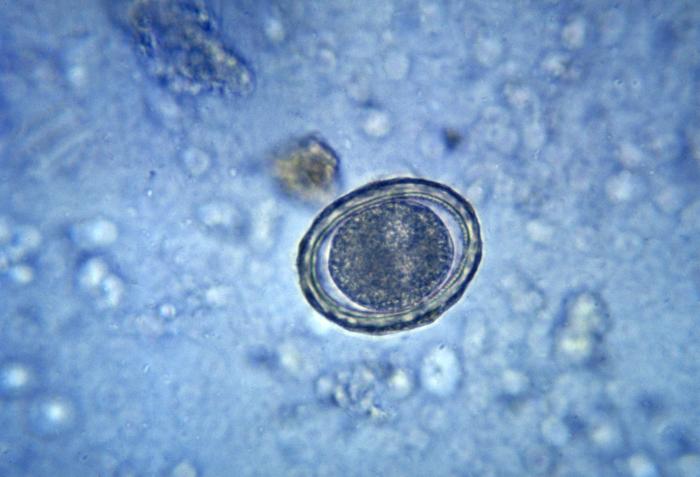 This micrograph reveals a fertilized egg of the round worm Ascaris lumbricoides; Mag. 400X. From Public Health Image Library (PHIL). [2]