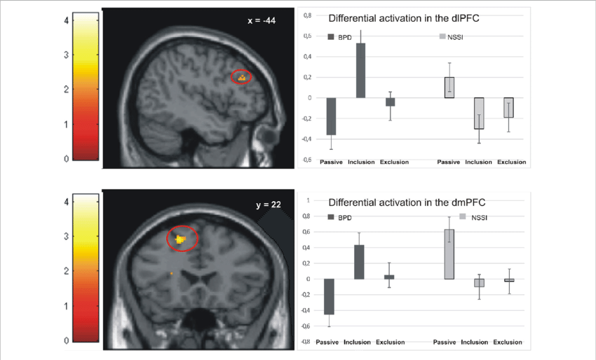 File:FMRI in Non suicidal self injury.png