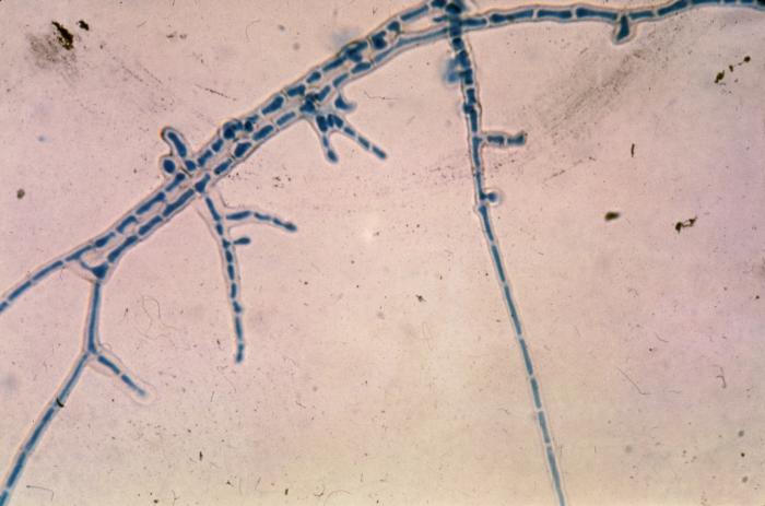 This is a photomicrograph of the mycelium of the fungus Piedraia hortae, magnified 475X. From Public Health Image Library (PHIL). [2]