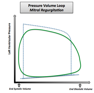 File:Pressure Volume Loop Mitral Regurgitation.png