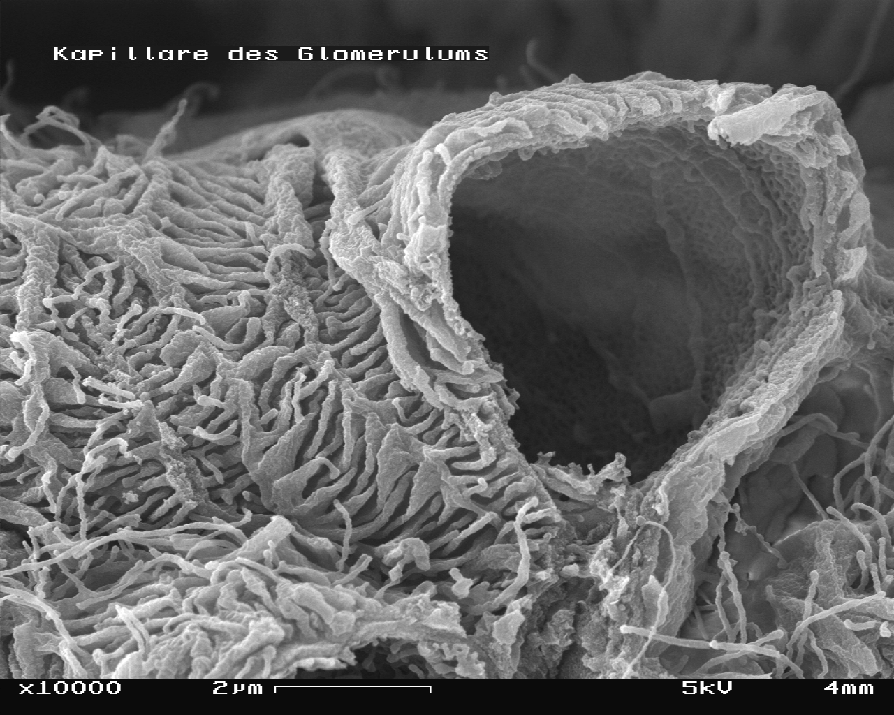 Mouse glomerulus in the SEM with one capillary broken, magnification 10,000x