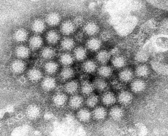 Transmission electron micrograph (TEM) revealed some of the ultrastructural morphology displayed by Norovirus virions. From Public Health Image Library (PHIL). [14]