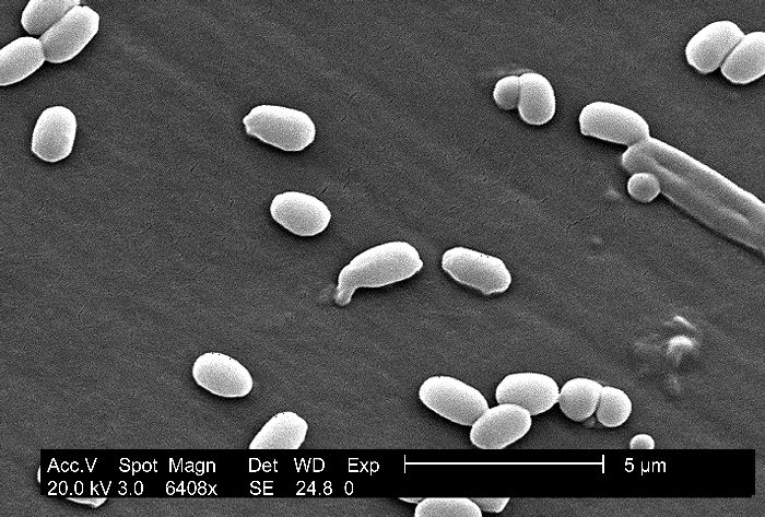 "Magnification of 6,408X, this scanning electron micrograph (SEM) depicted spores from the Aimes strain of Bacillus anthracis bacteria.”Adapted from Public Health Image Library (PHIL), Centers for Disease Control and Prevention.[20]
