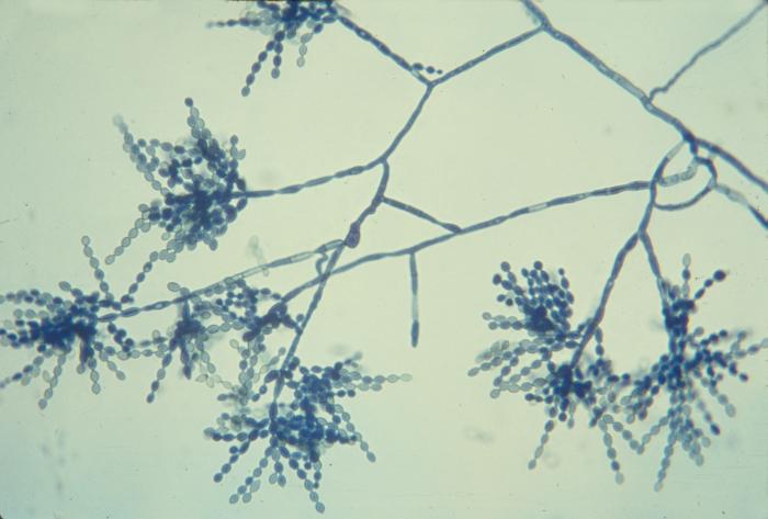 Photomicrograph of Cladophialophora carrionii (475X mag). From Public Health Image Library (PHIL). [3]