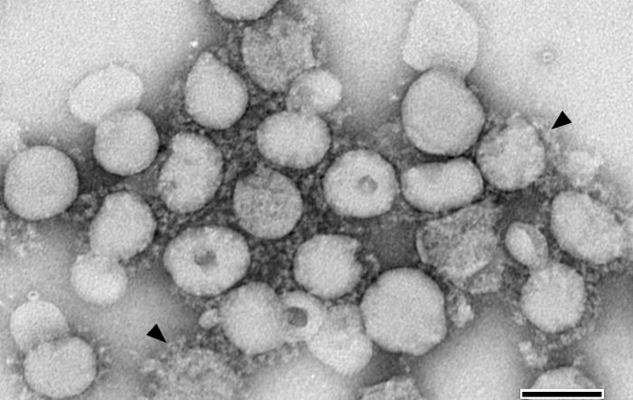 TEM from a tissue culture isolate, revealing numbers of severe acute respiratory virus (SARS) virions. From Public Health Image Library (PHIL). [2]