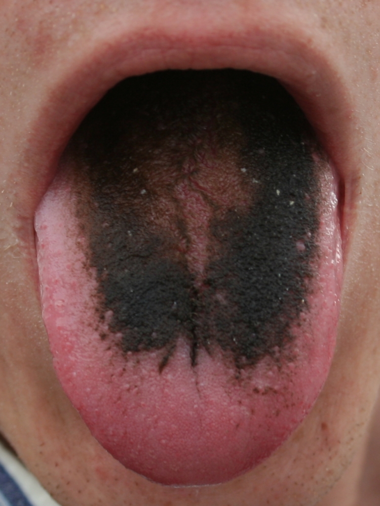 Black tounge.jpg