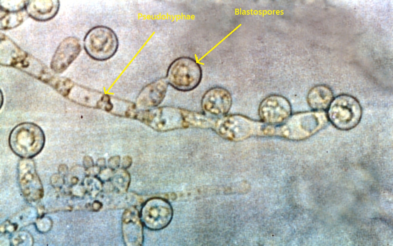 File:Candida albicans 2 - By GrahamColm - Own work, CC BY-SA 3.0, httpscommons.wikimedia.orgwindex.phpcurid=10921762.jpg