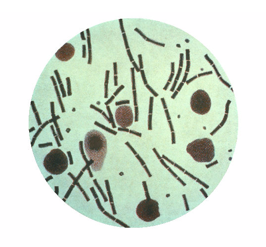 "Bacillus anthracis taken from the peritoneum using a Hiss capsule stain.”Adapted from Public Health Image Library (PHIL), Centers for Disease Control and Prevention.[20]