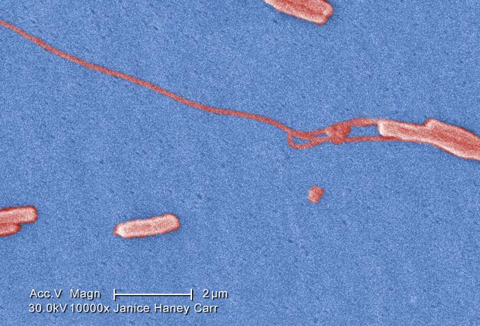 File:Legionella microscopy 2.jpg