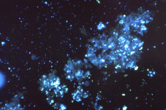 Magnified 125X, "digested", then stained using a fluorescent antibody-staining technique, this photomicrograph reveals the presence of Histoplasma capsulatum antigens in this human lung tissue specimen. From Public Health Image Library (PHIL). [5]