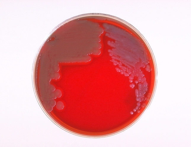 "Sheep blood agar plate culture of Bacillus anthracis and Bacillus cereus”Adapted from Public Health Image Library (PHIL), Centers for Disease Control and Prevention.[21]