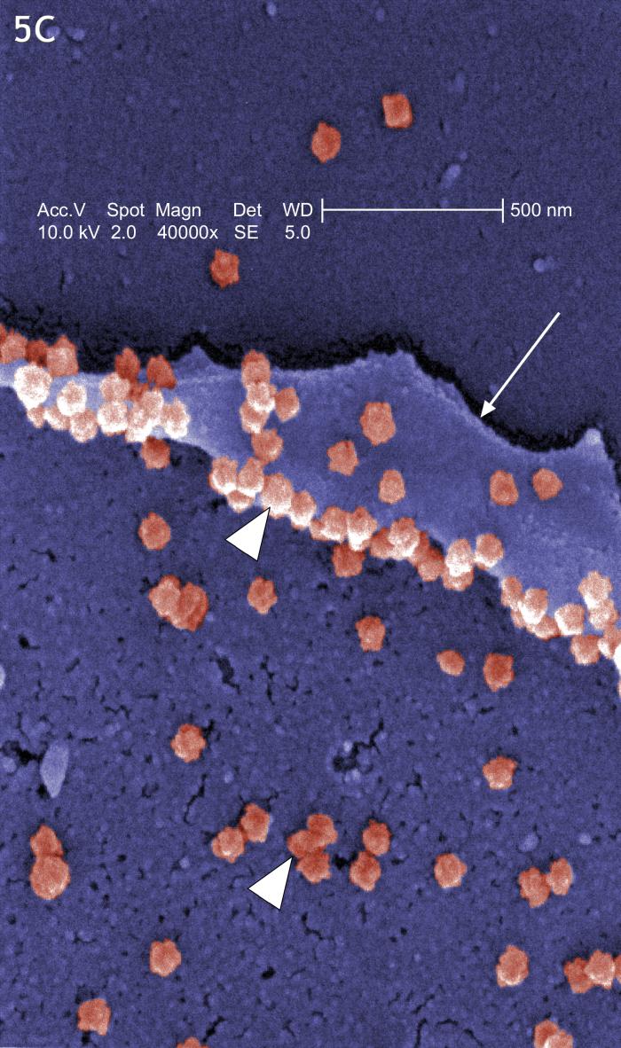 Scanning electron micrograph reveals the prolific exportation of virus particles at the pseudopodial and cell surfaces. From Public Health Image Library (PHIL). [3]