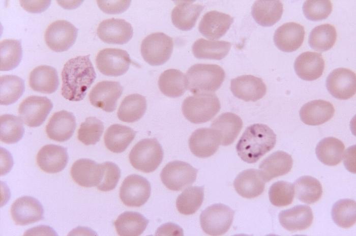 Magnified 1125X, this thin film photomicrograph of a blood smear, revealed the presence of a triple ring-form Plasmodium vivax trophozoite on the right, and a young, growing amoeboid trophozoite on the lef, both displaying intracytoplasmic Schüffner's dots Adapted from Public Health Image Library (PHIL), Centers for Disease Control and Prevention.[6]