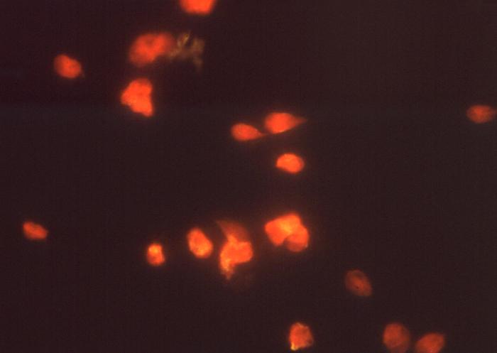 This photomicrograph depicts Giardia lamblia parasites using indirect immunofluorescence test for giardiasis. From Public Health Image Library (PHIL). [1]