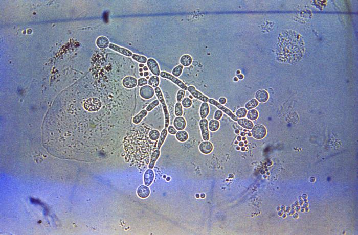 Sputum specimen reveals the presence of chlamydospores of the fungal organism, Candida albicans, in a case of invasive pulmonary candidiasis. From Public Health Image Library (PHIL). [9]