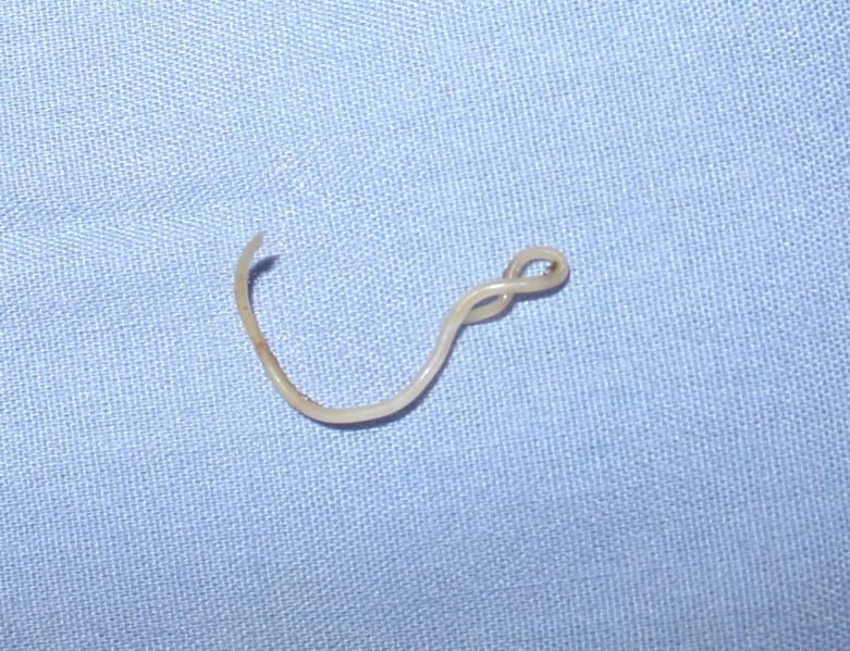 File:Canine roundworm 1.JPG