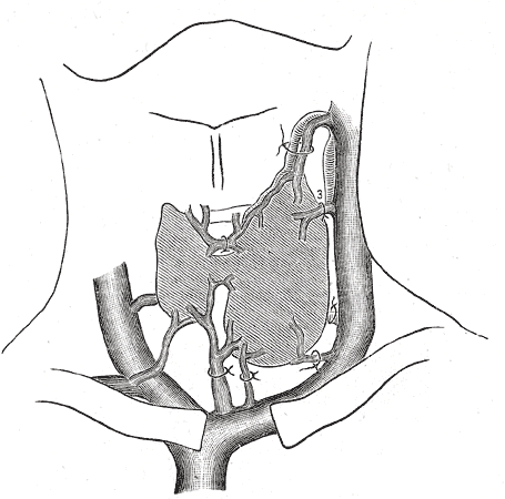 Diagram showing common arrangement of thyroid veins.