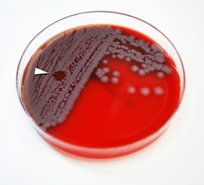 Bacillus anthracis bacterial colonies, which had been allowed to grow on sheep’s blood agar (SBA) for a 24 hour period. In this particular view you’ll note the appearance of what is termed a "plaque" (arrowhead), which represents an area where the bacteria had been lysed, or destroyed by the application of a localized amount of gamma phage-containing solution. Highly specific toB. anthracis, these gamma phage viruses, i.e., bacteriophages, attacked the B. anthracis bacteria, subsequently leaving this circular plaque devoid of bacterial organisms. The specificity of these gamma phages to B. anthracis makes this a positive test for the presence of this bacterium.”Adapted from Public Health Image Library (PHIL), Centers for Disease Control and Prevention.[20]