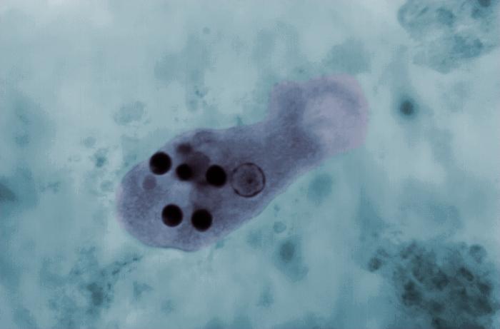 Entamoeba histolytica. From Public Health Image Library (PHIL). [8]