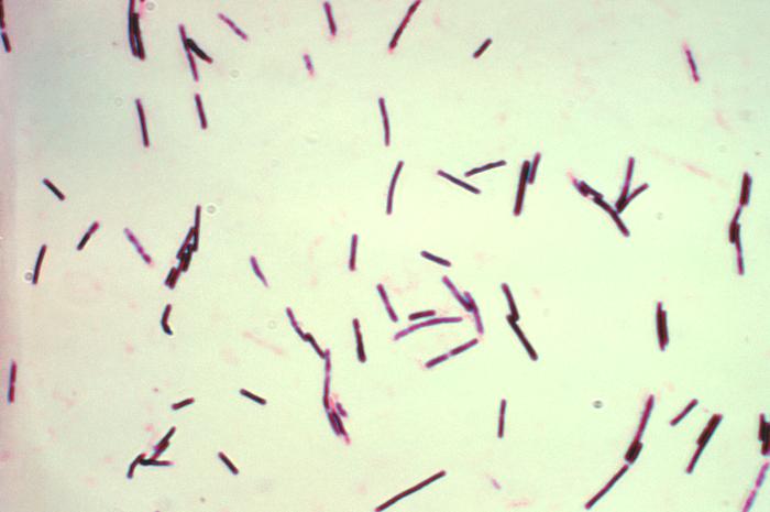 Photomicrograph of gram-positive Clostridium perfringens bacilli.