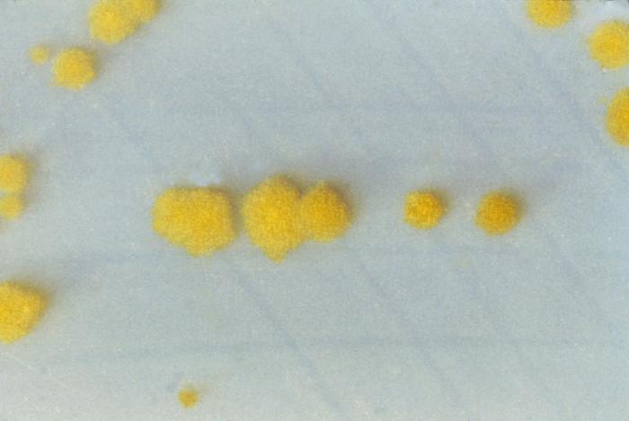 Clostridium difficile colonies grown on cycloserine mannitol agar after 48 hours. From Public Health Image Library (PHIL). [1]