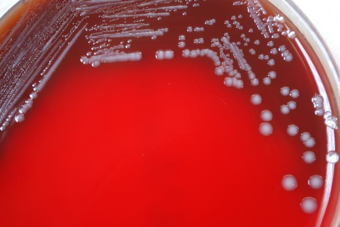 Gram-negative Yersinia pestis bacteria, which was grown on a medium of sheep’s blood agar (SBA) 72hrs. From Public Health Image Library (PHIL). [18]