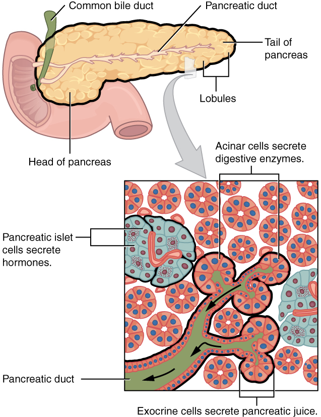 File:Pancreatic cancer classification.jpg
