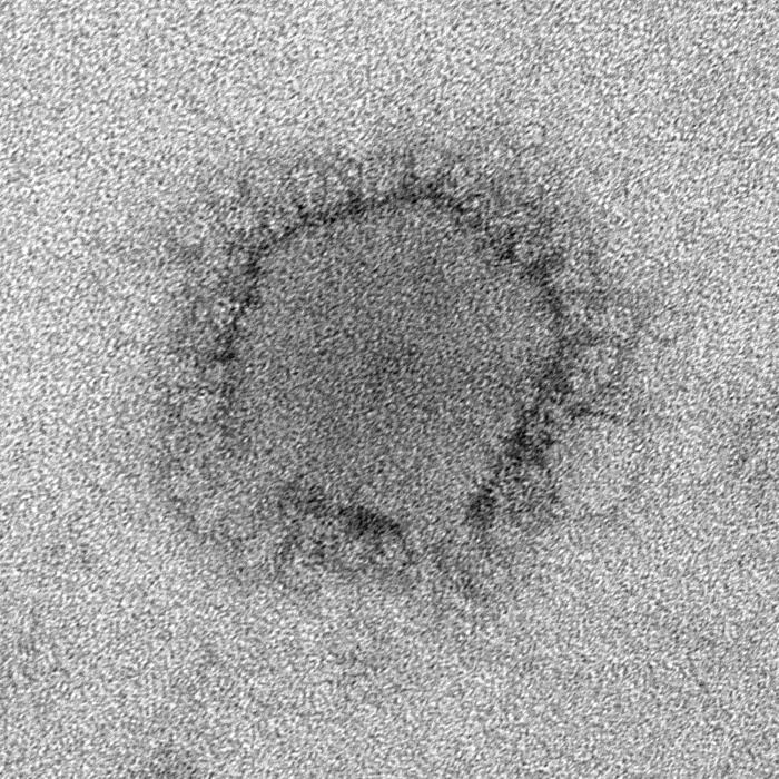 TEM reveals ultrastructural morphology of the Middle East Respiratory Syndrome Coronavirus (MERS-CoV). From Public Health Image Library (PHIL). [18]