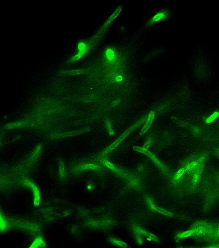 "B. anthracis Direct Fluorescent Antibody (DFA) cell wall stain.”Adapted from Public Health Image Library (PHIL), Centers for Disease Control and Prevention.[20]